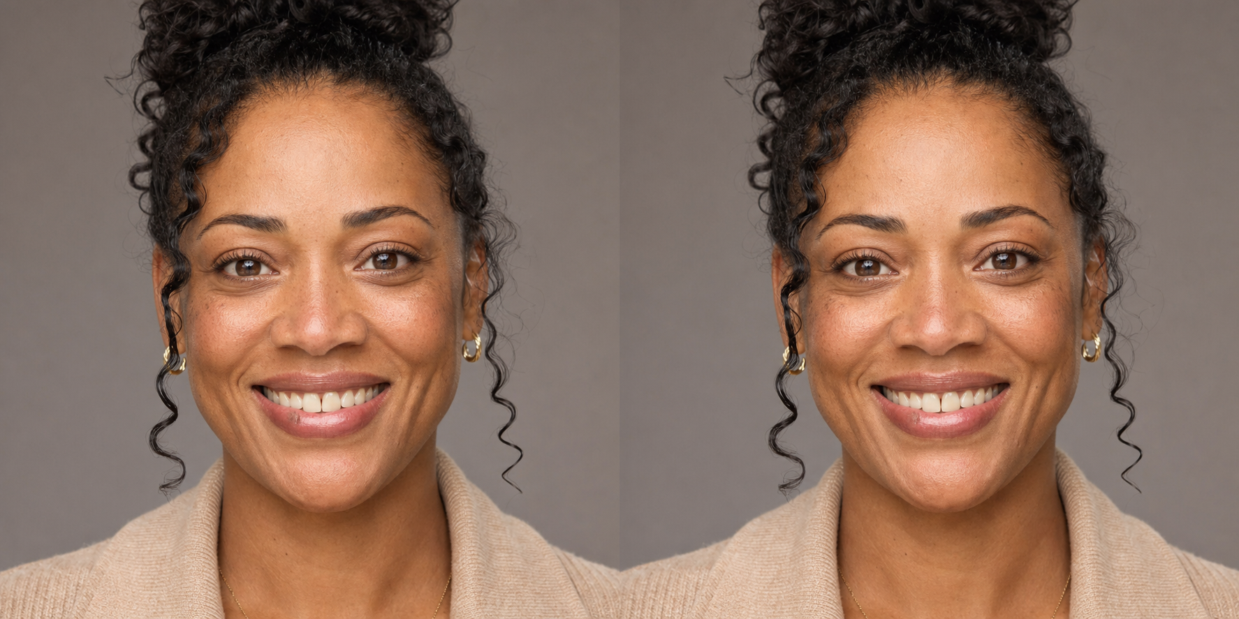 Illustrative before and after smile preview featuring the same fictional woman