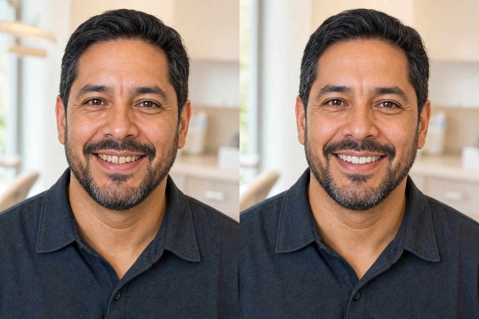 Illustrative before and after smile preview featuring the same fictional man