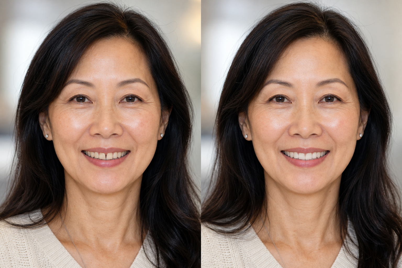 Illustrative before and after smile preview featuring the same fictional woman